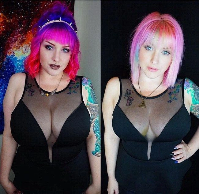 Жінці довелося зменшити розмір грудей (5 фото) – фото 5