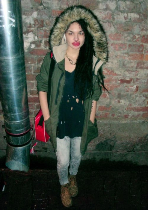 Нові вуха Крістіни Рей (13 фото) – фото 1