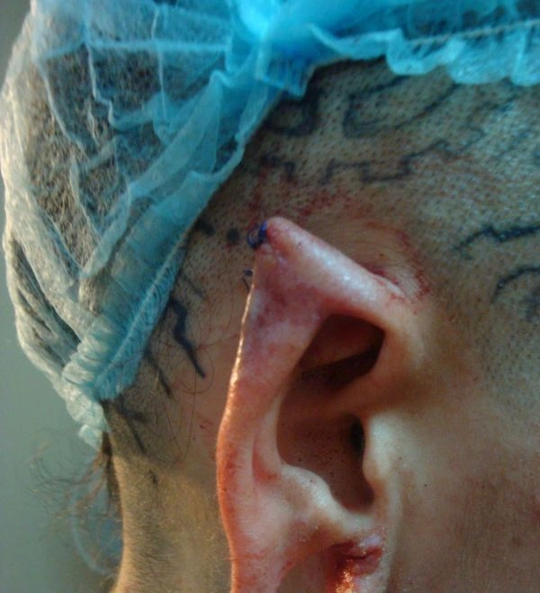 Нові вуха Крістіни Рей (13 фото) – фото 2