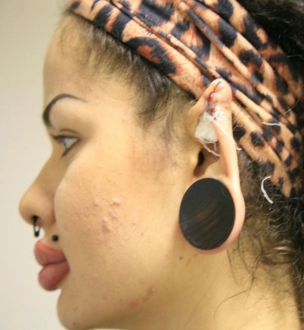 Нові вуха Крістіни Рей (13 фото) – фото 3