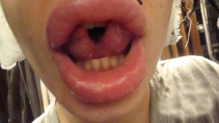 Нові вуха Крістіни Рей (13 фото) – фото 11