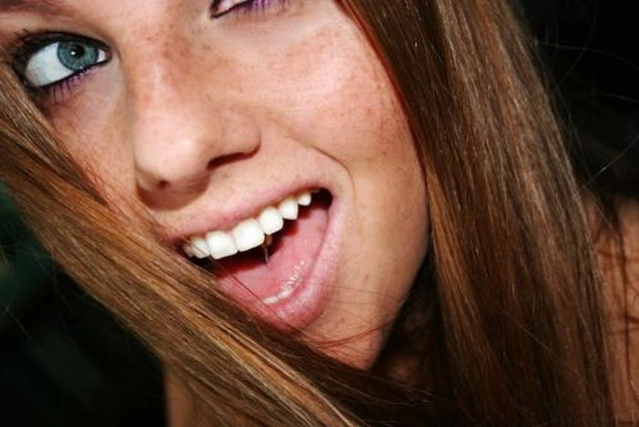 Дівчата з веснянками (115 фото) – фото 52