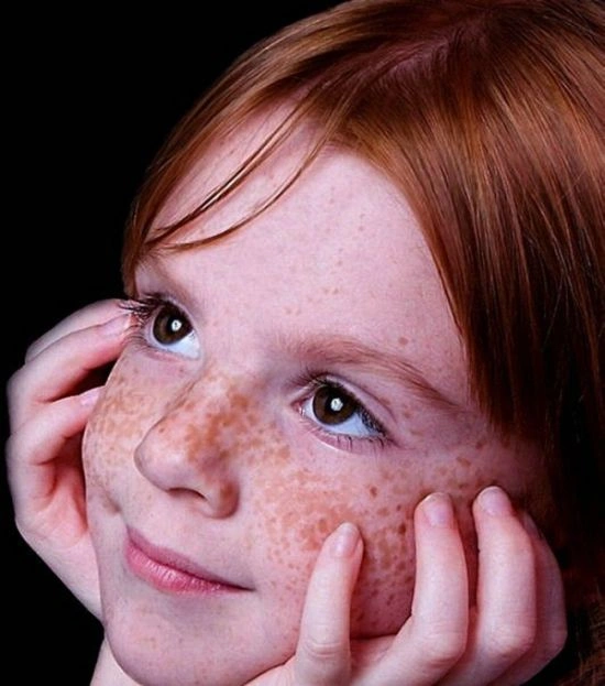Дівчата з веснянками (115 фото) – фото 54