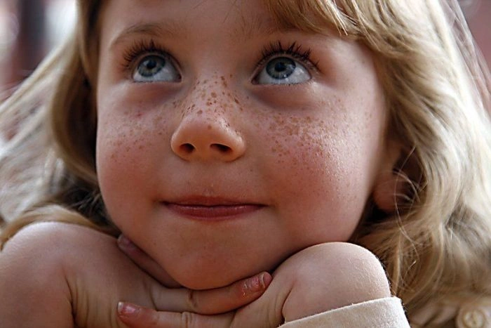 Дівчата з веснянками (115 фото) – фото 57