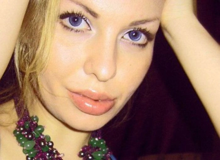 Кілограми силікону (20 фото) – фото 19