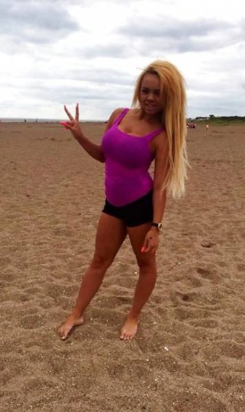 Дівчина переборщила з ботоксом і силіконом (21 фото) – фото 1