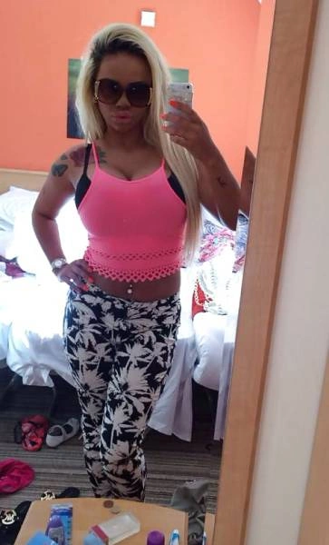 Дівчина переборщила з ботоксом і силіконом (21 фото) – фото 2