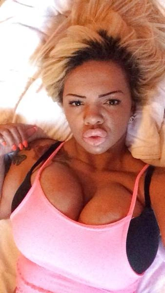 Дівчина переборщила з ботоксом і силіконом (21 фото) – фото 3