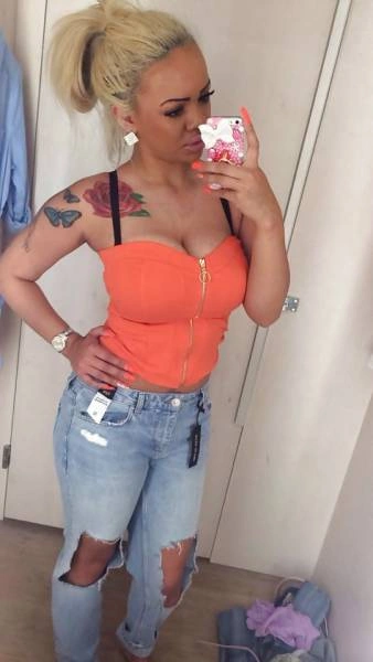 Дівчина переборщила з ботоксом і силіконом (21 фото) – фото 5