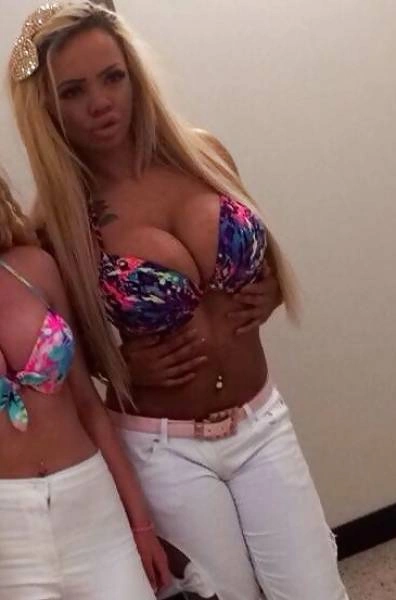 Дівчина переборщила з ботоксом і силіконом (21 фото) – фото 8