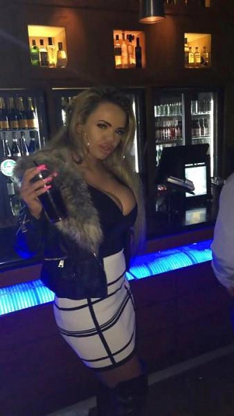 Дівчина переборщила з ботоксом і силіконом (21 фото) – фото 12