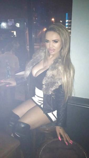 Дівчина переборщила з ботоксом і силіконом (21 фото) – фото 13