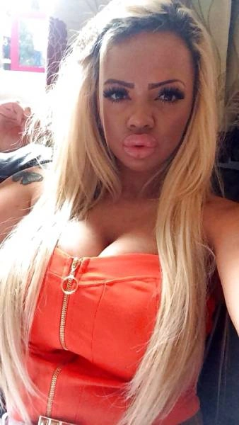 Дівчина переборщила з ботоксом і силіконом (21 фото) – фото 16