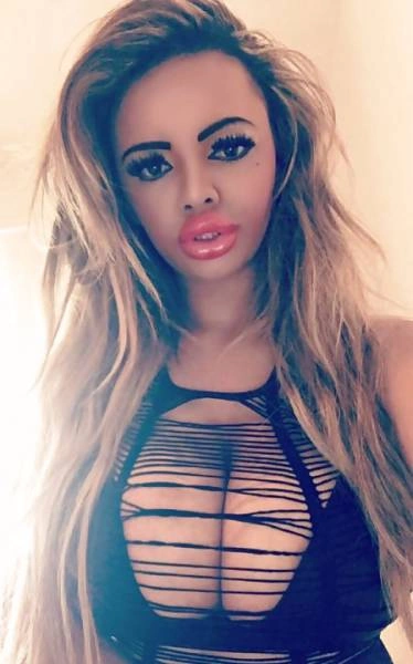 Дівчина переборщила з ботоксом і силіконом (21 фото) – фото 17