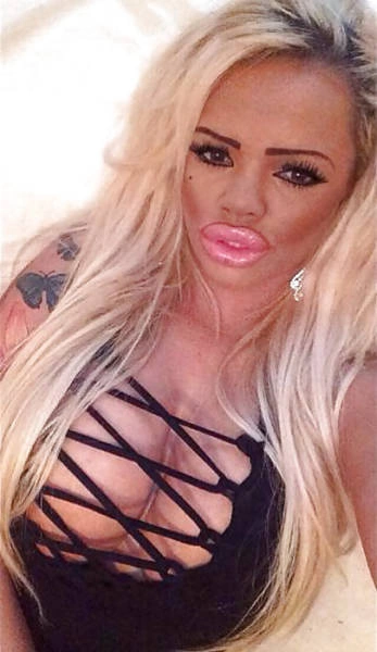 Дівчина переборщила з ботоксом і силіконом (21 фото) – фото 20