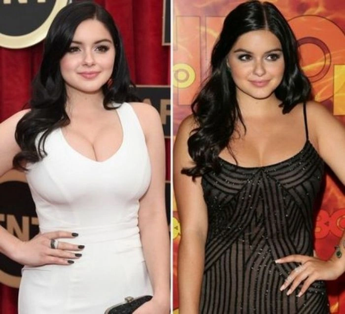 Знаменитості, які зменшили груди (47 фото) – фото 12