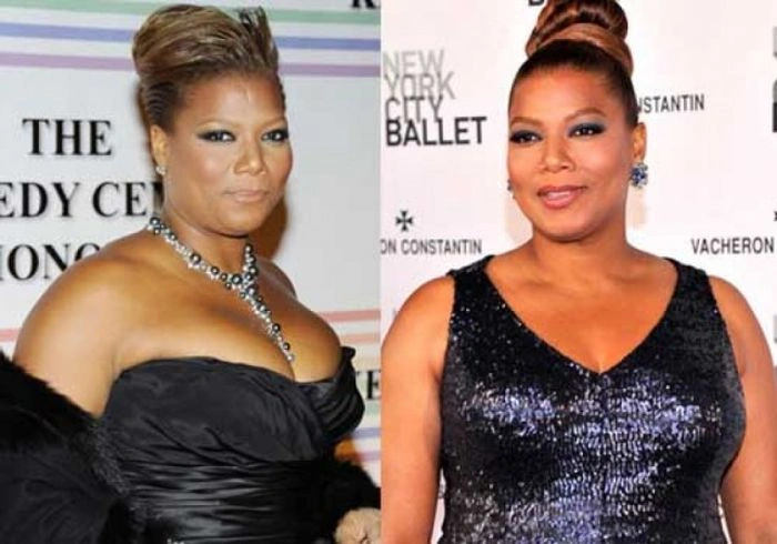 Знаменитості, які зменшили груди (47 фото) – фото 20