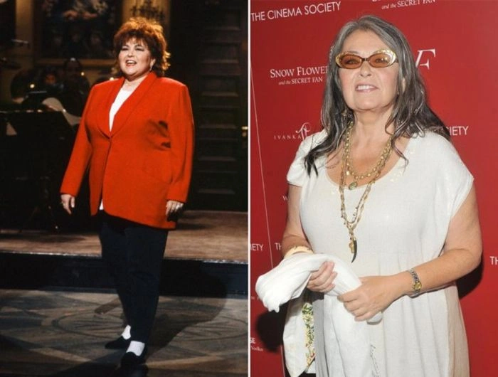 Знаменитості, які зменшили груди (47 фото) – фото 21