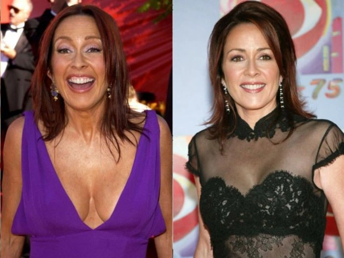 Знаменитості, які зменшили груди (47 фото) – фото 29