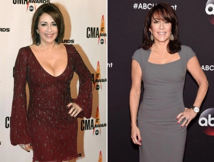 Знаменитості, які зменшили груди (47 фото) – фото 30