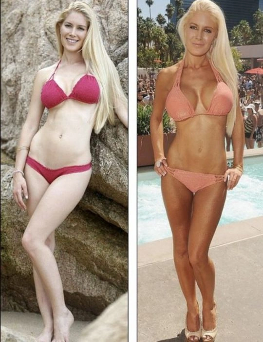 Знаменитості, які зменшили груди (47 фото) – фото 33