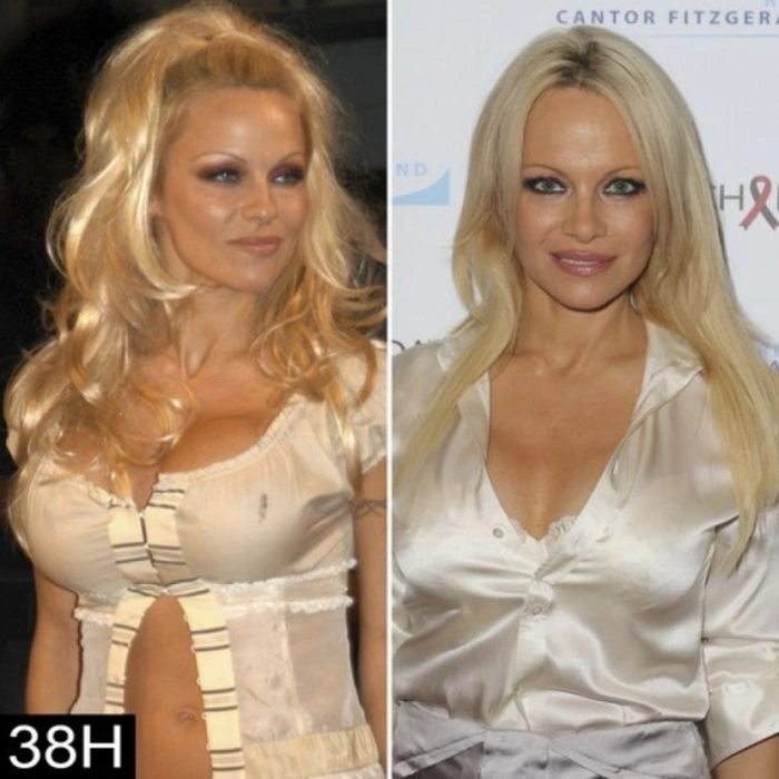 Знаменитості, які зменшили груди (47 фото) – фото 38