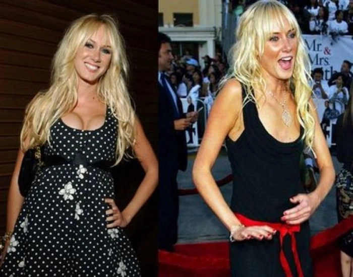 Знаменитості, які зменшили груди (47 фото) – фото 46