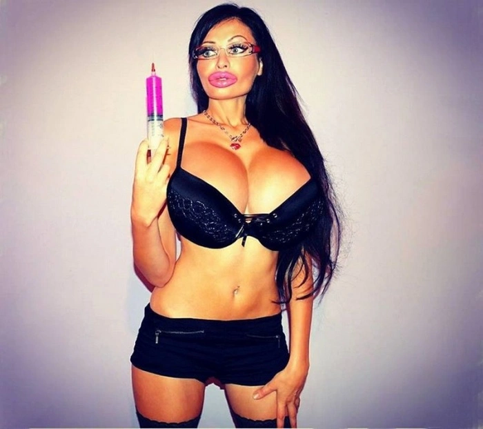 Прихильниця пластичної хірургії Вікторія Уайлд отримала новий п'ятий елемент (21 фото) – фото 14