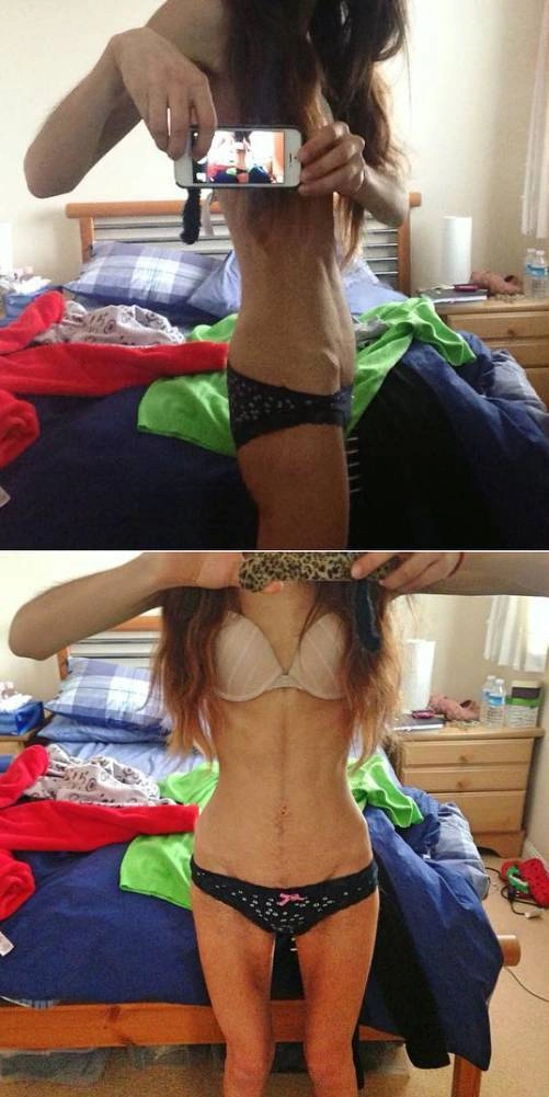 Дівчина подолала анорексію і захопилась бодібілдінгом (26 фото) – фото 3