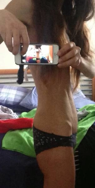 Дівчина подолала анорексію і захопилась бодібілдінгом (26 фото) – фото 4