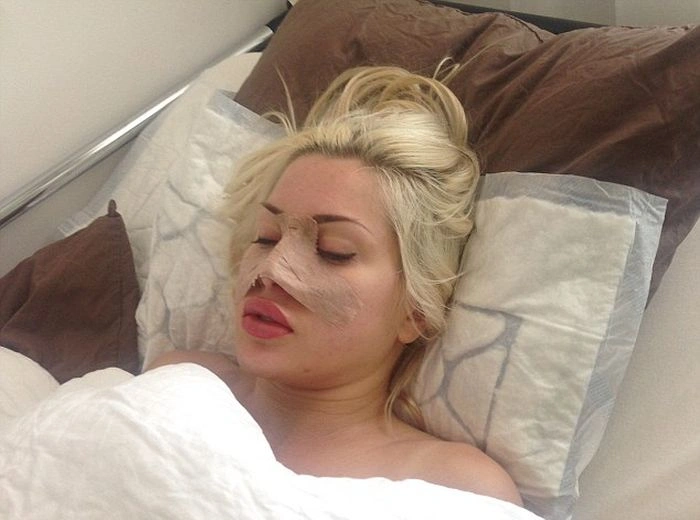 Шведка витратила 120 000 доларів, щоб виглядати як Джессіка Роббіт (17 фото) – фото 4