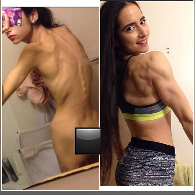 Дівчина, яка страждала від анорексії, одужала і зайнялась бодібілдингом (9 фото) – фото 5