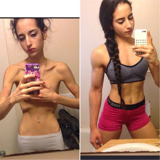 Дівчина, яка страждала від анорексії, одужала і зайнялась бодібілдингом (9 фото) – фото 6