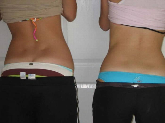 Ямки на спині (79 фото) – фото 30