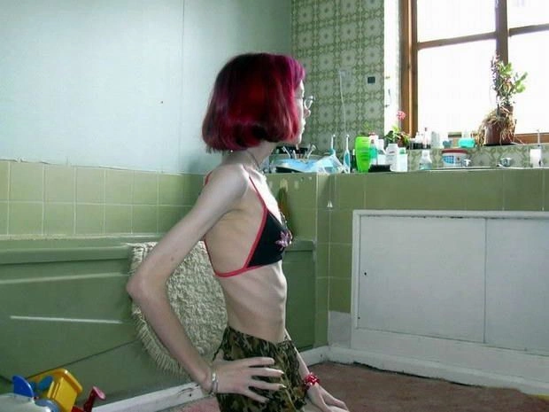 Дівчата, що віддалися дієті (15 фото) – фото 2