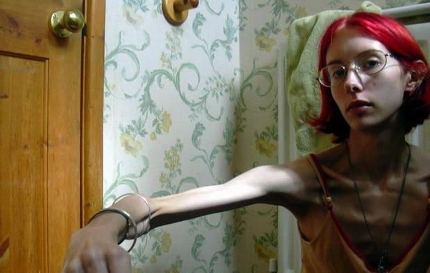 Дівчата, що віддалися дієті (15 фото) – фото 3