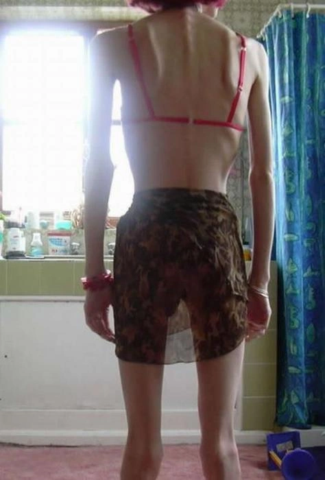 Дівчата, що віддалися дієті (15 фото) – фото 4