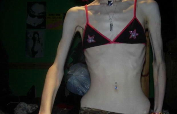 Дівчата, що віддалися дієті (15 фото) – фото 5