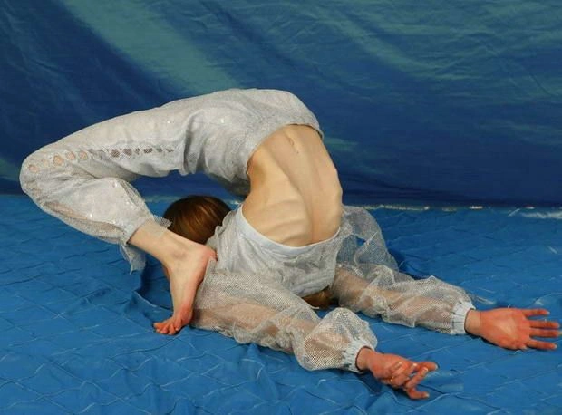 Дівчата, що віддалися дієті (15 фото) – фото 9